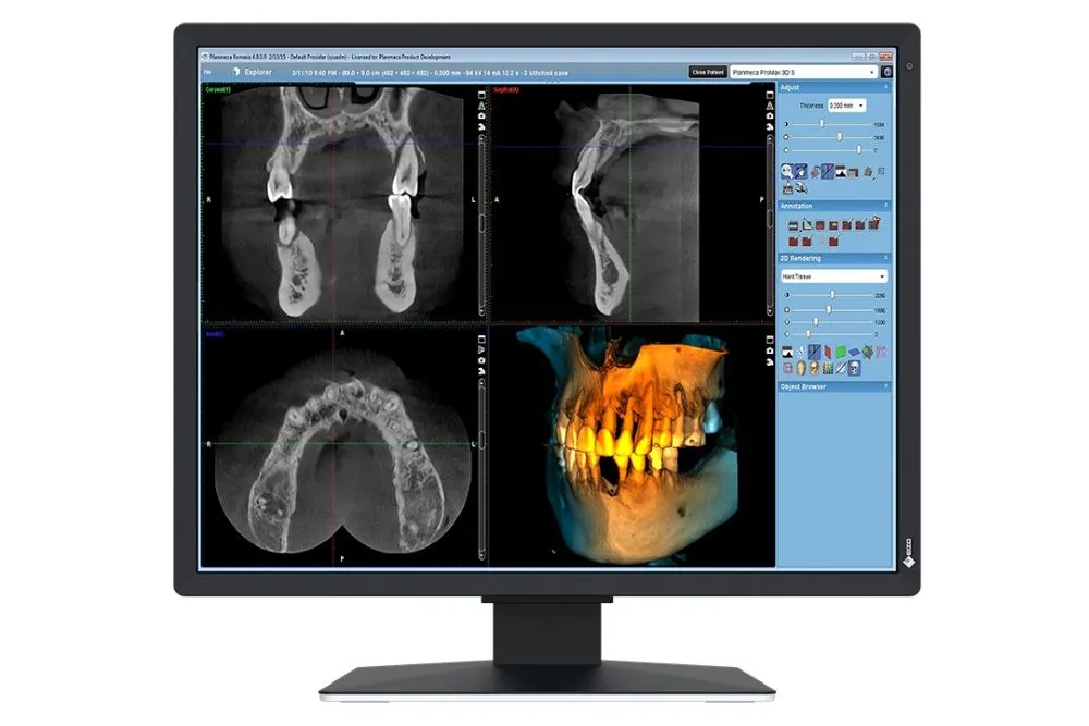 2 MP-Medizin-Monitor für die 2D-Befundung im Befundungsraum (RK 5) 2 MP-Medizin-Monitor für die 2D-Befundung im Befundungsraum (RK 5)