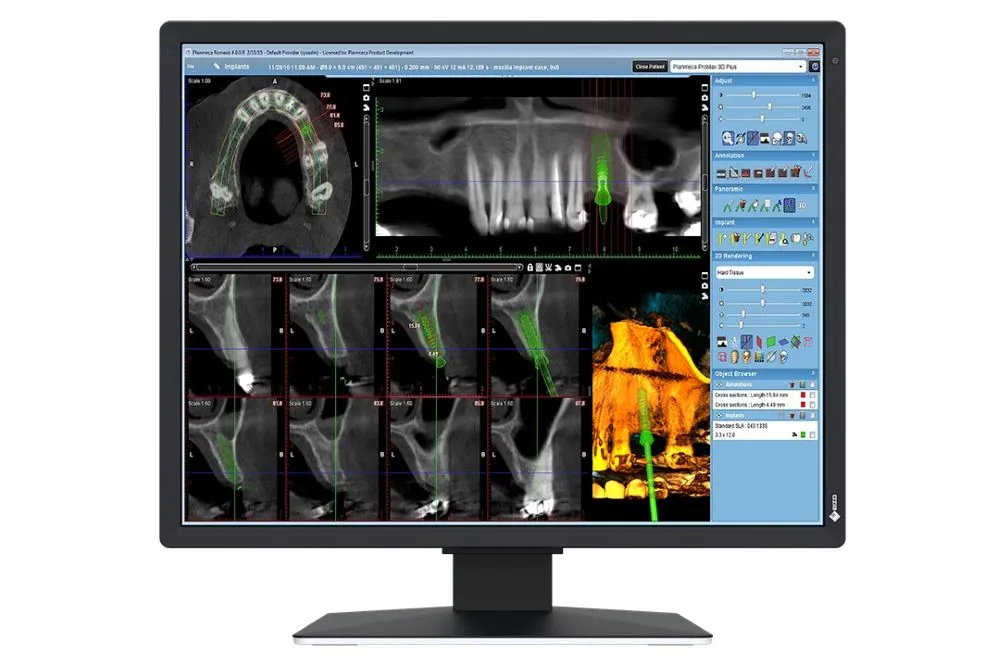 2 MP-Medizin-Monitor für die 2D-Befundung im Behandlungsraum (RK 6) 2 MP-Medizin-Monitor für die 2D-Befundung im Behandlungsraum (RK 6)