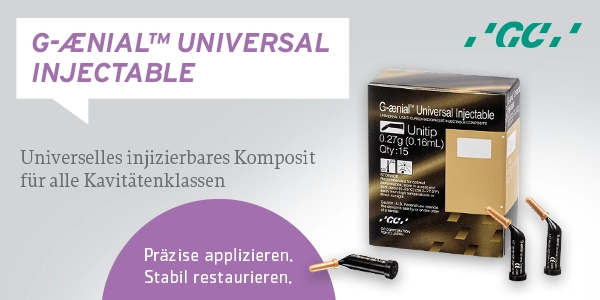 GC G-ænial® Universal Injectable - universelles injizierbares Komposit für alle Kavitätenklassen GC G-ænial® Universal Injectable