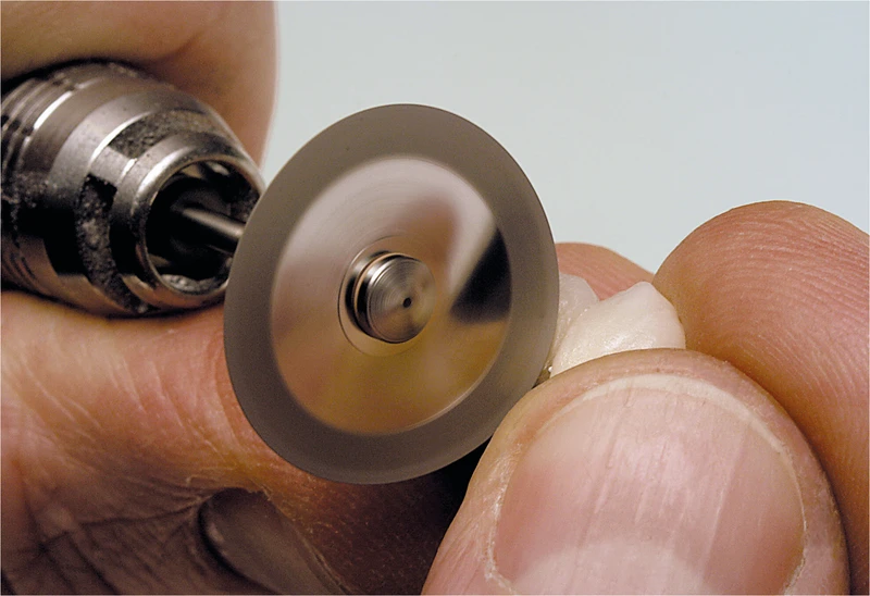 Stück beidseitig, Ø 22 mm, S: 0,15 mm